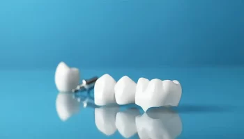 Dental Crowns for Cracked or Broken Teeth: A Guide for Seattle Residents